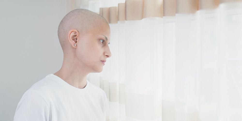 Eine Patientin leidet an Haarausfall als Nebenwirkung der Chemotherapie.