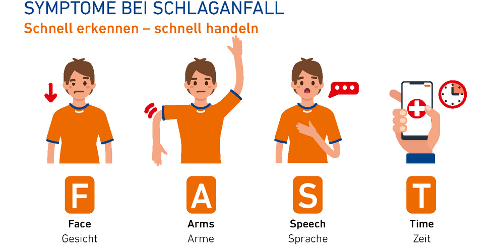 Die Grafik zeigt die 4 Schritte des FAST-Schnelltests bei einem Schlaganfall.